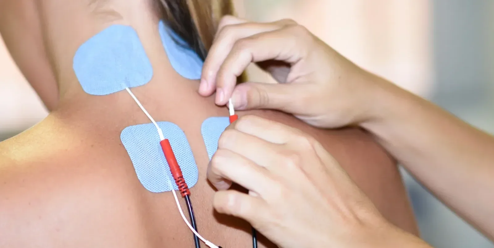 Clinician placing electrical stimulation electrodes on a patient's upper back